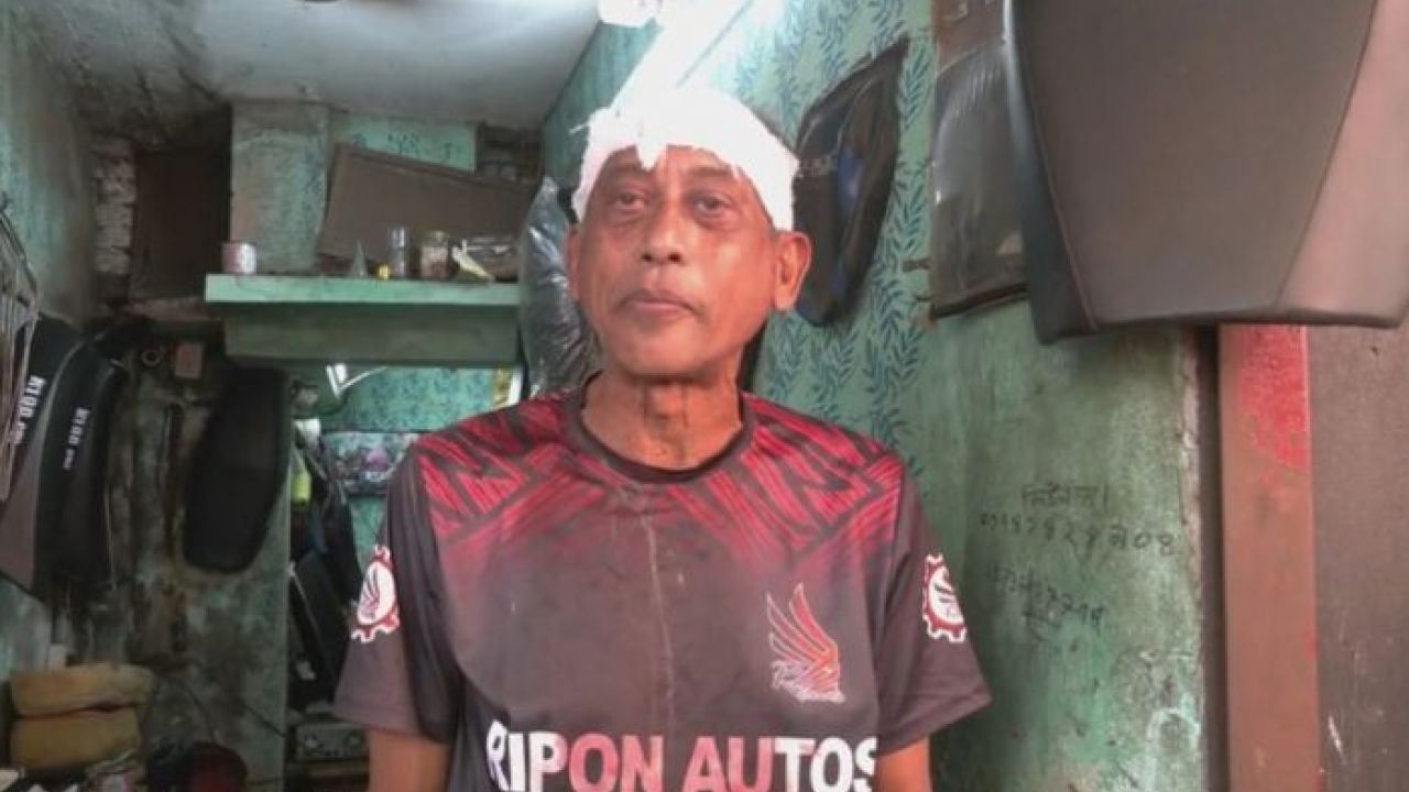 যশোরে ময়লা ফেলা নিয়ে কথাকাটাকাটি: চিত্রশিল্পী সমু চৌধুরীকে লাঠিপেটা করে আহত করার অভিযোগ