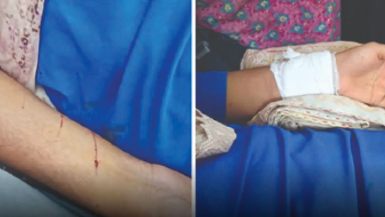 সীতাকুণ্ডে স্কুলছাত্রীকে ছুরিকাঘাত করে স্বর্ণালংকার ছিনতাই